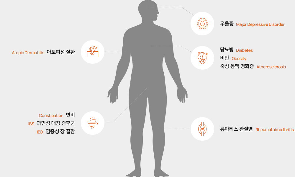 장내 미생물과 관련된 대표적인 질환